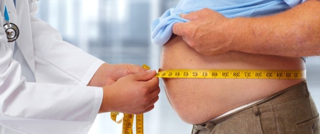 Obesity and Over Weight